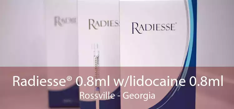 Radiesse® 0.8ml w/lidocaine 0.8ml Rossville - Georgia
