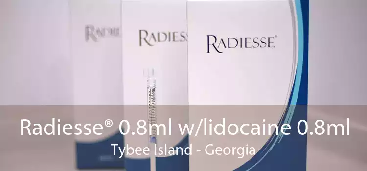 Radiesse® 0.8ml w/lidocaine 0.8ml Tybee Island - Georgia