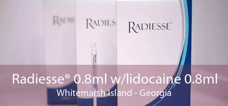 Radiesse® 0.8ml w/lidocaine 0.8ml Whitemarsh Island - Georgia