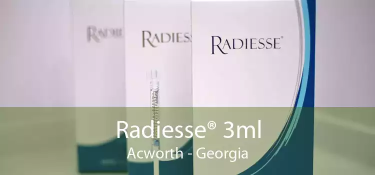 Radiesse® 3ml Acworth - Georgia