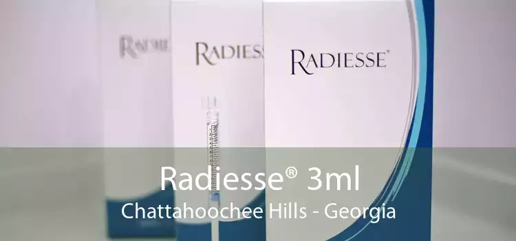 Radiesse® 3ml Chattahoochee Hills - Georgia