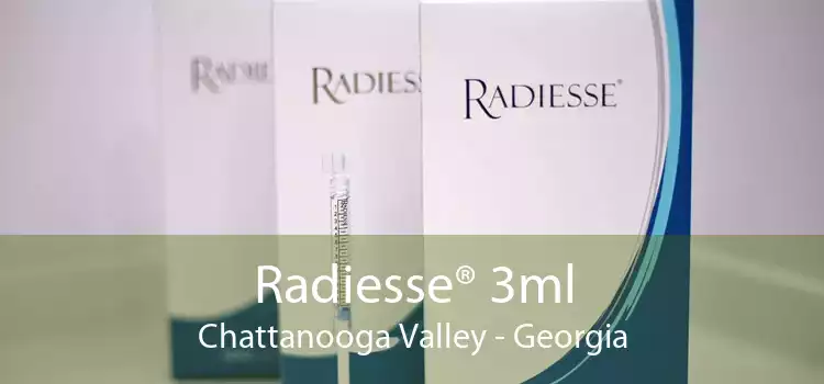 Radiesse® 3ml Chattanooga Valley - Georgia