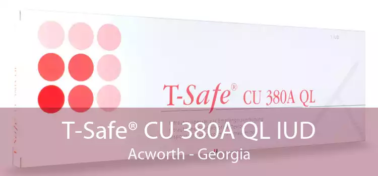 T-Safe® CU 380A QL IUD Acworth - Georgia