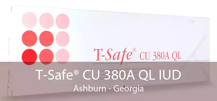 T-Safe® CU 380A QL IUD Ashburn - Georgia