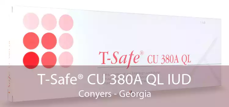 T-Safe® CU 380A QL IUD Conyers - Georgia