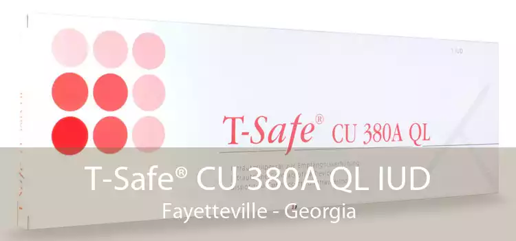 T-Safe® CU 380A QL IUD Fayetteville - Georgia