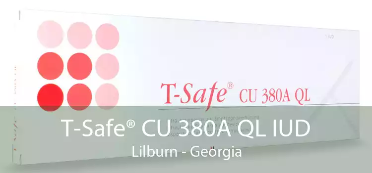 T-Safe® CU 380A QL IUD Lilburn - Georgia