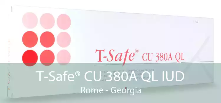 T-Safe® CU 380A QL IUD Rome - Georgia