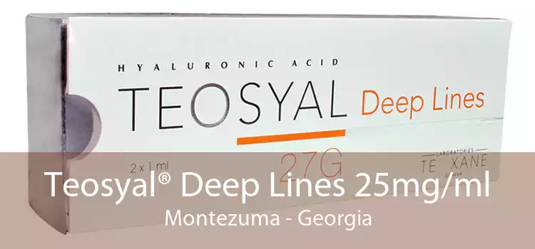 Teosyal® Deep Lines 25mg/ml Montezuma - Georgia
