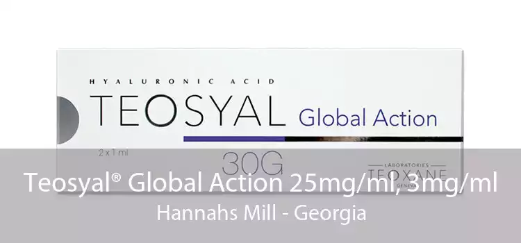 Teosyal® Global Action 25mg/ml, 3mg/ml Hannahs Mill - Georgia