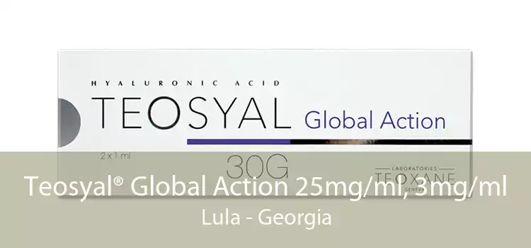 Teosyal® Global Action 25mg/ml, 3mg/ml Lula - Georgia