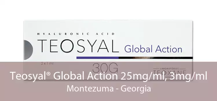 Teosyal® Global Action 25mg/ml, 3mg/ml Montezuma - Georgia