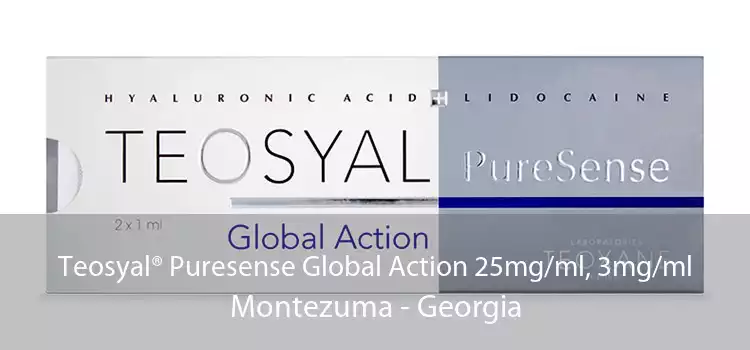 Teosyal® Puresense Global Action 25mg/ml, 3mg/ml Montezuma - Georgia
